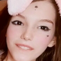 AbnormalXO Desnuda