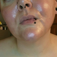 blemishedbeauty Desnuda