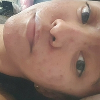 xsugarvulpesx Desnuda